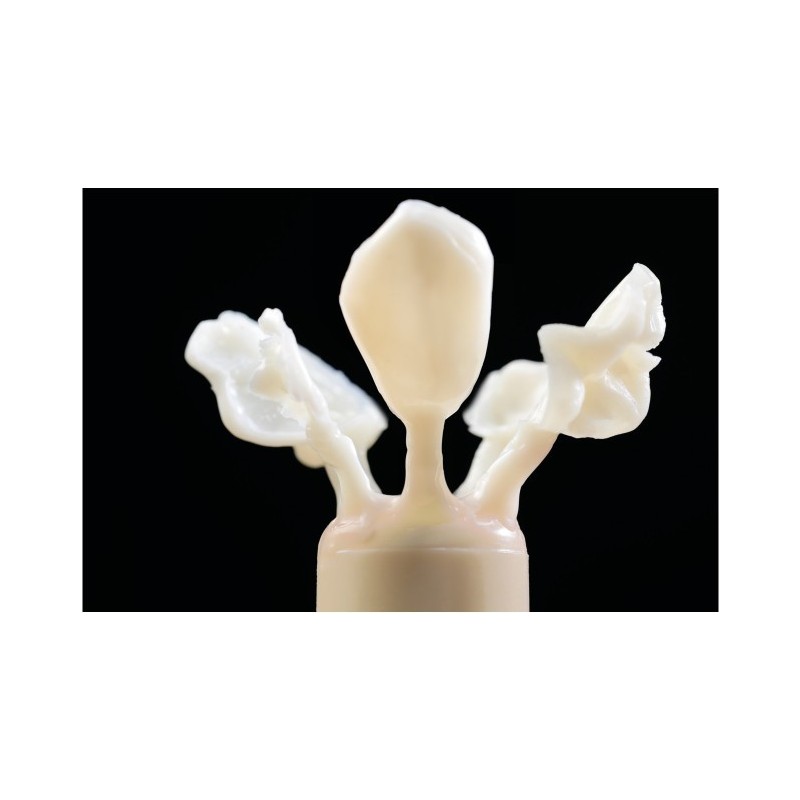 Shera Under pressure